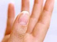 3代试管全部明细费用多少？