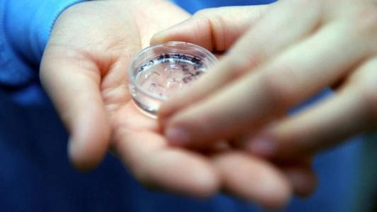 2025年拉拉去西南医科附属医院做精子试管的成功率高吗？详细